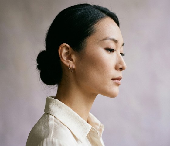 精准去双下巴手术效果